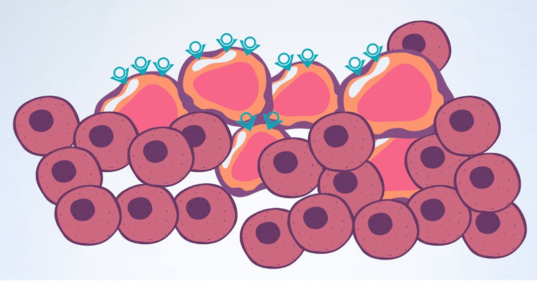 MUHC launches phase 2 radioligand therapy trial